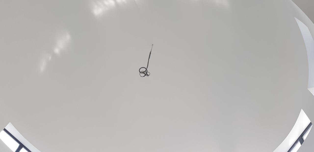 20180222_110400